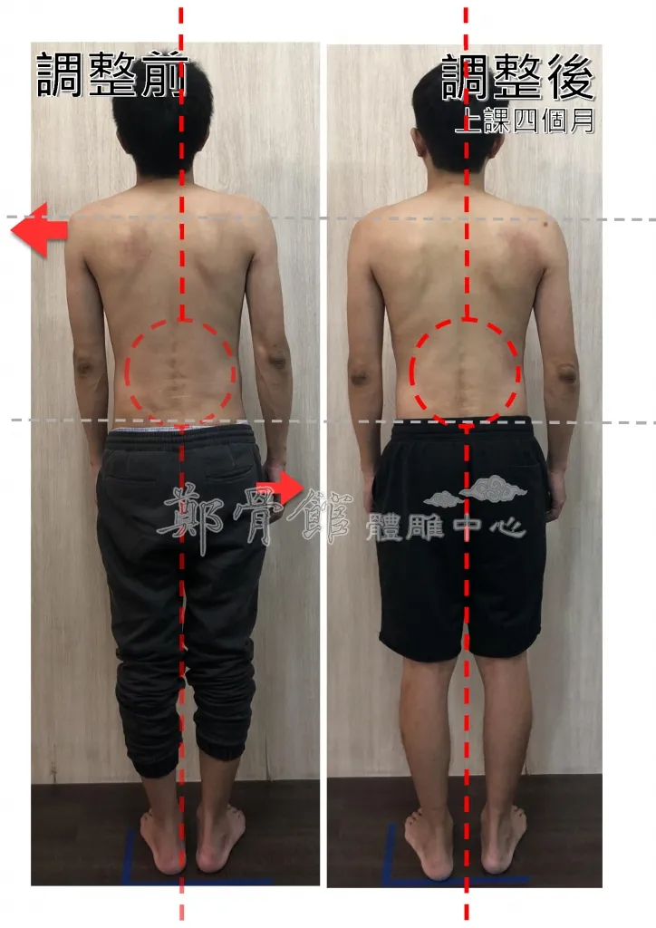 鄭骨館體雕中心調理前後對比：上課四個月後身體中軸與體態明顯回正